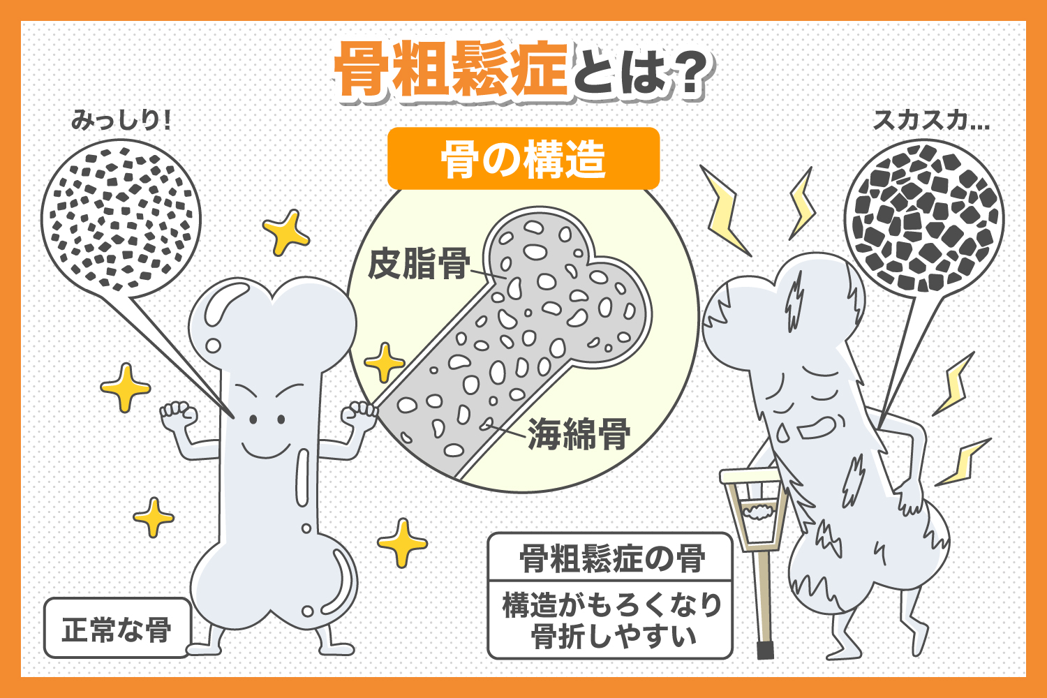 骨粗鬆症の段階