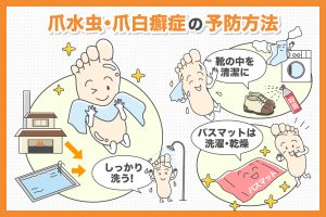 爪水虫・爪白癬症の予防方法