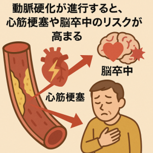 動脈硬化が進行するリスク