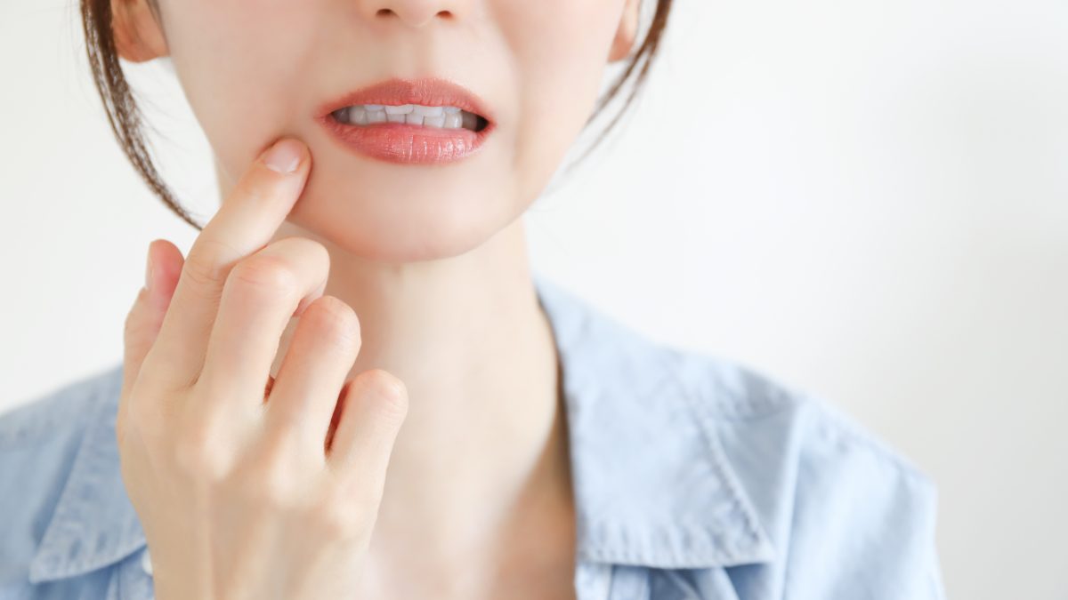 白い口内炎が治らない？原因と治し方を解説