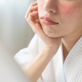 尋常性白斑は治った人がいる？自然治癒から最新治療まで徹底解説