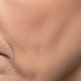 口周りのシワをなくす方法｜セルフケアから美容医療まで徹底解説