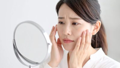 尋常性白斑の原因とは？ストレスや遺伝との関係、発症メカニズムを徹底解説