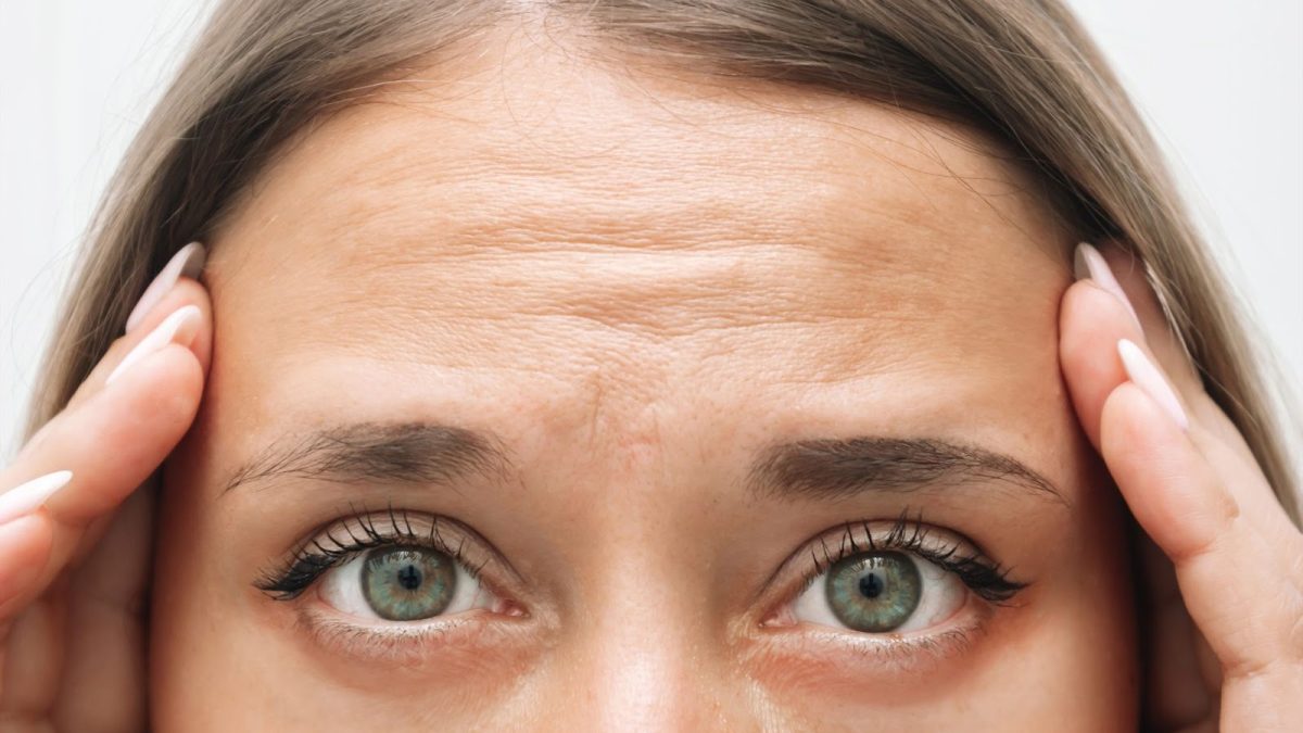 おでこのシワを改善するには？原因別の効果的なセルフケアと美容医療の選び方