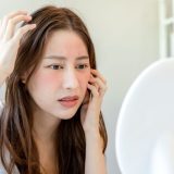 酒さ（赤ら顔）の原因は？悪化因子・ニキビダニとの関係や完治への道を徹底解説