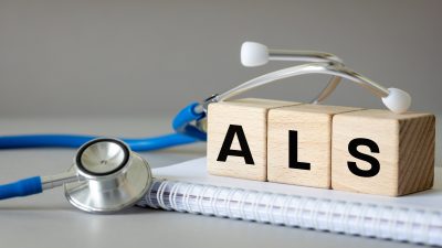 ALS（筋萎縮性側索硬化症）になりやすい人の特徴とは？発症リスクと初期症状を解説