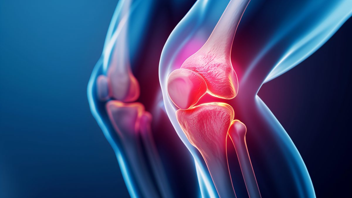 変形性膝関節症は手術しないで治せる？「保存療法」と「最新治療」の選択肢