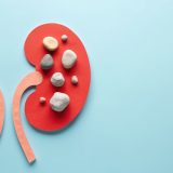 尿路結石とストレスの関係：原因、症状、そして今日からできる予防策