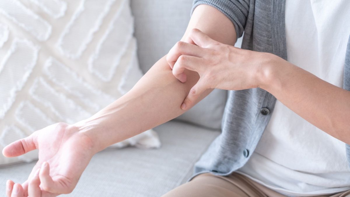 蕁麻疹の原因はストレス？つらい痒みの治し方と「心と肌」の休ませ方