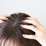脂漏性皮膚炎で頭皮にかさぶたができる原因は？正しい治し方と剥がしてはいけない理由