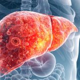 脂肪肝で「お腹が出る」本当の理由とは？内臓脂肪・腹水・肝腫大のメカニズムと改善策