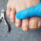 爪水虫と間違えやすい病気7つ｜市販薬が効かない理由