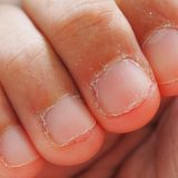 子供の爪噛み、発達障害が関係？親ができる原因理解と寄り添う対応策