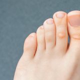 爪の横を押すと痛いのはなぜ？主な原因と症状別の鑑別ポイント・対処法