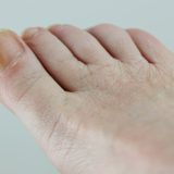爪が白く濁る原因は？爪白癬・カンジダから全身の病気のサインまで