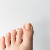 足の爪の変色は何が原因？黒・白・黄色・緑の色別に見分け方と受診の目安
